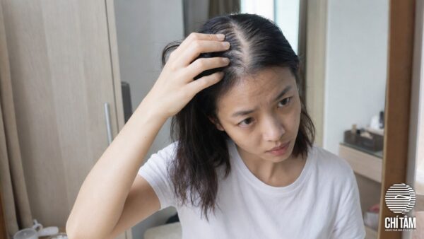 Phụ nữ Việt vén tóc soi gương thấy đường ngôi rộng do tóc mỏng thưa